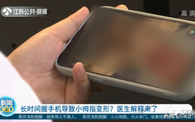 你拿手機(jī)時(shí)是這個(gè)姿勢(shì)嗎？醫(yī)生這則提醒很重要！縮略圖